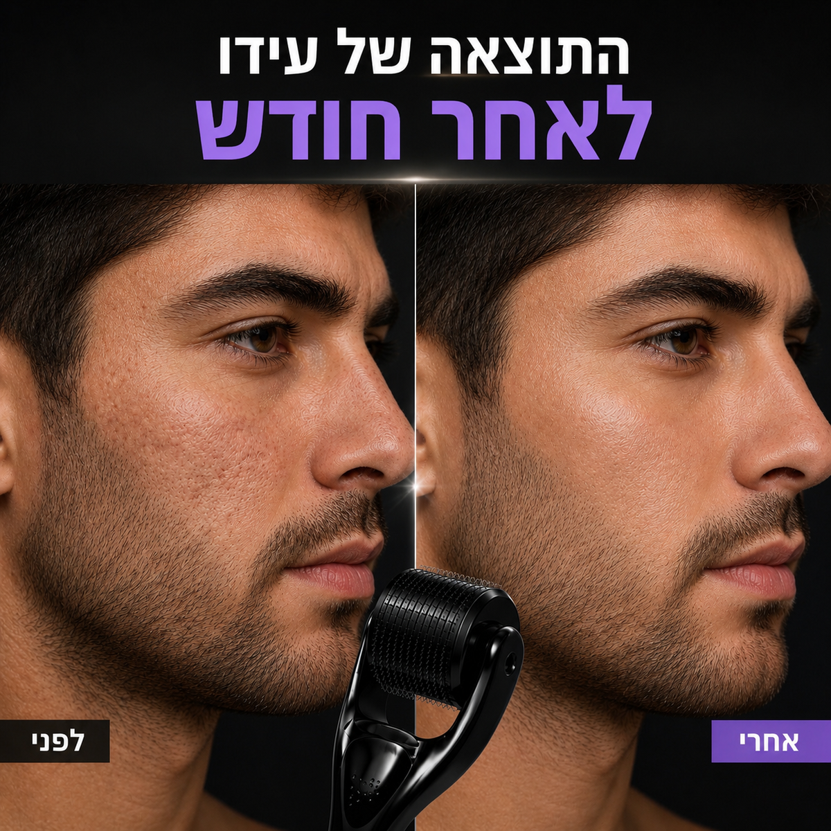 רולר לעיסוי עור הפנים